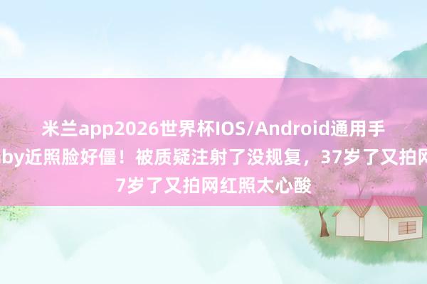 米兰app2026世界杯IOS/Android通用手机版下载 baby近照脸好僵！被质疑注射了没规复，37岁了又拍网红照太心酸